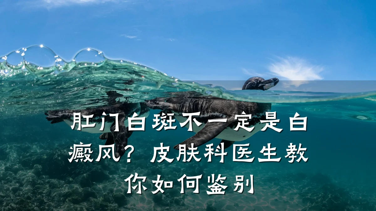 肛门白斑不一定是白癜风?皮肤科医生教你如何鉴别