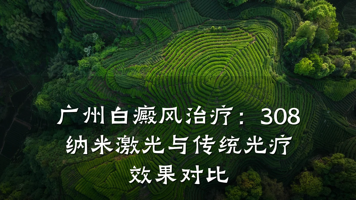 广州白癜风治疗:308纳米激光与传统光疗效果对比