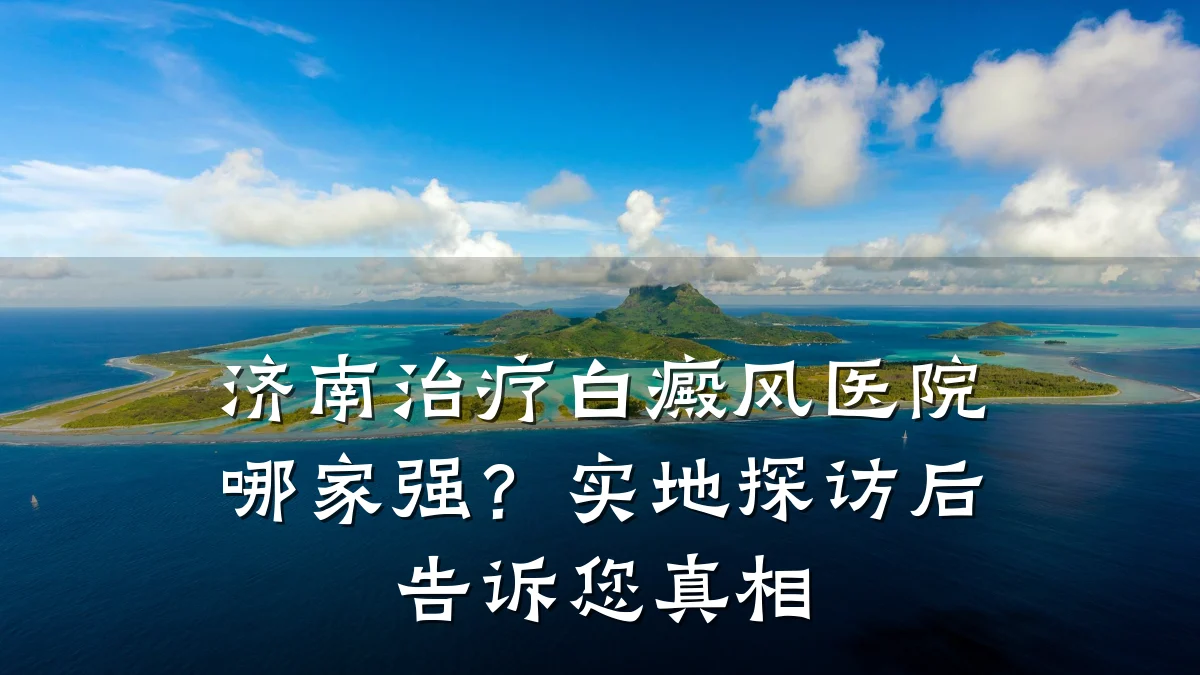 济南治疗白癜风医院哪家强?实地探访后告诉您真相