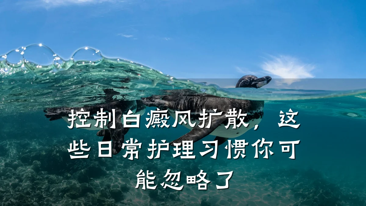 控制白癜风扩散，这些日常护理习惯你可能忽略了