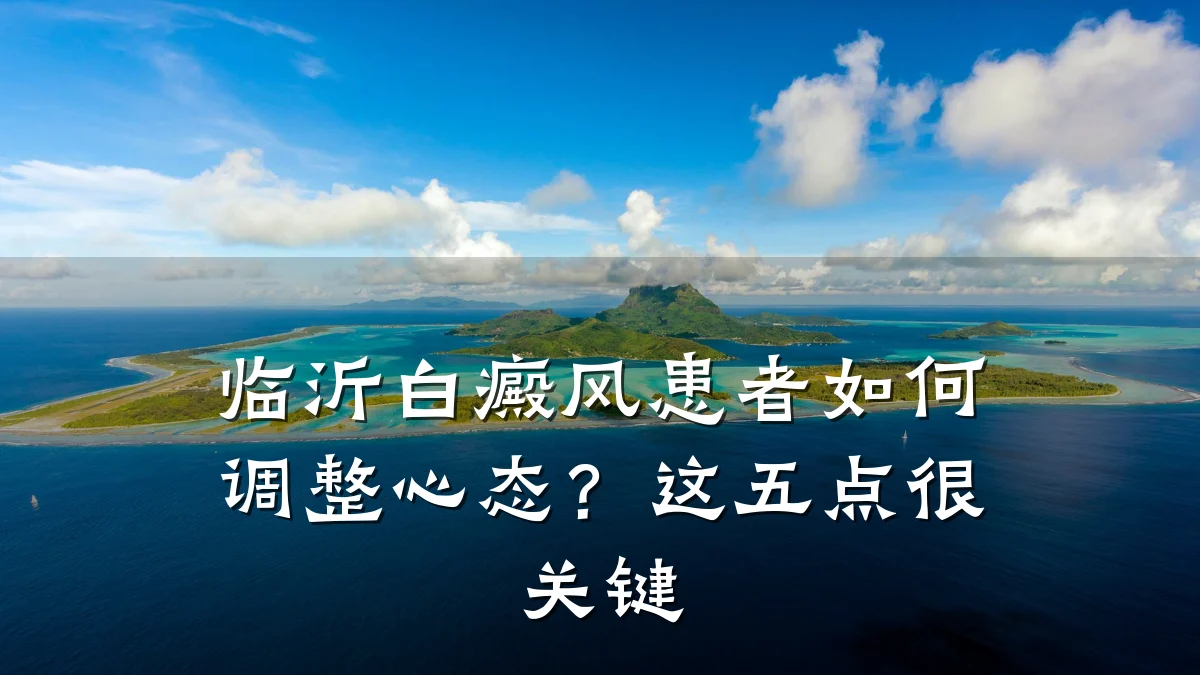 临沂白癜风患者如何调整心态?这五点很关键