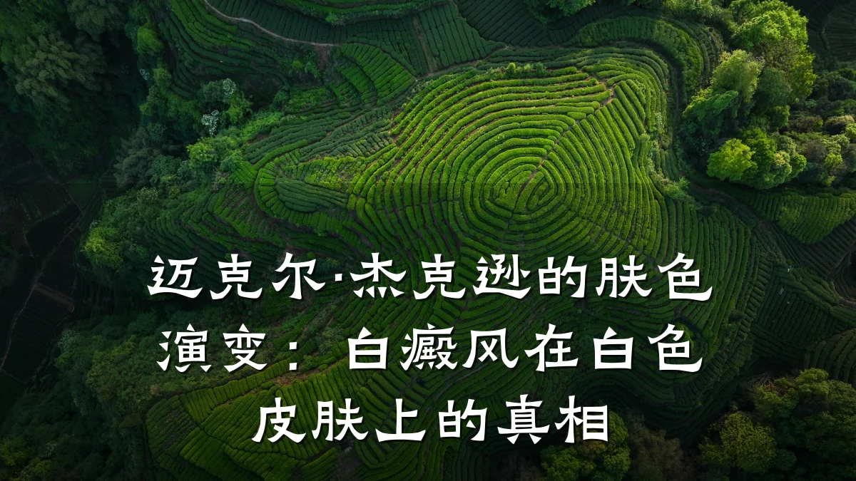 迈克尔·杰克逊的肤色演变:白癜风在白色皮肤上的真相