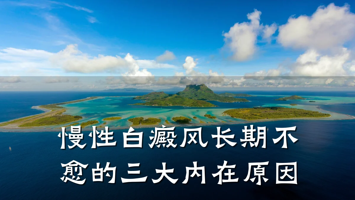 慢性白癜风长期不愈的三大内在原因