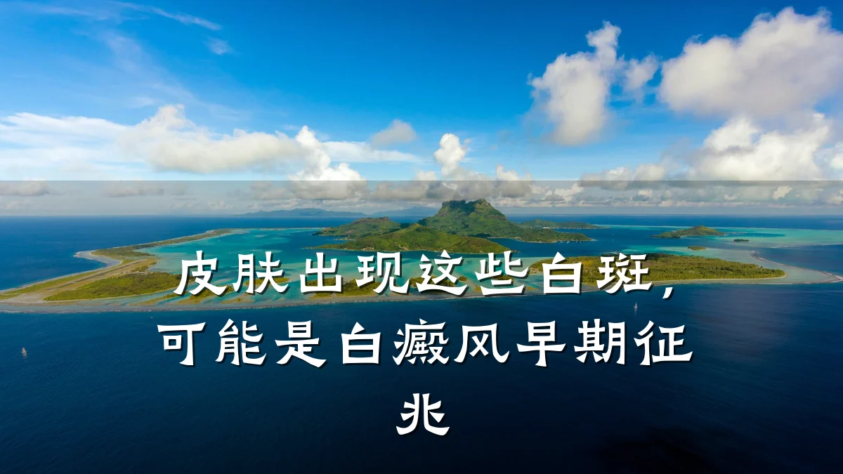 皮肤出现这些白斑,可能是白癜风早期征兆