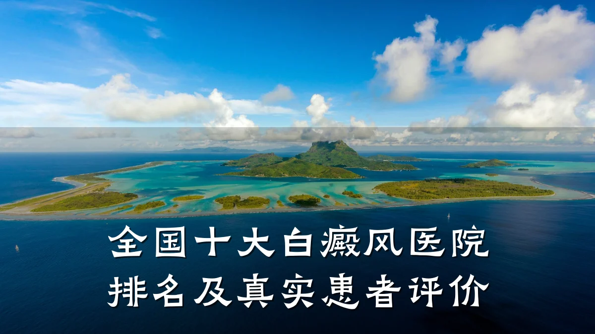全国十大白癜风医院排名及真实患者评价