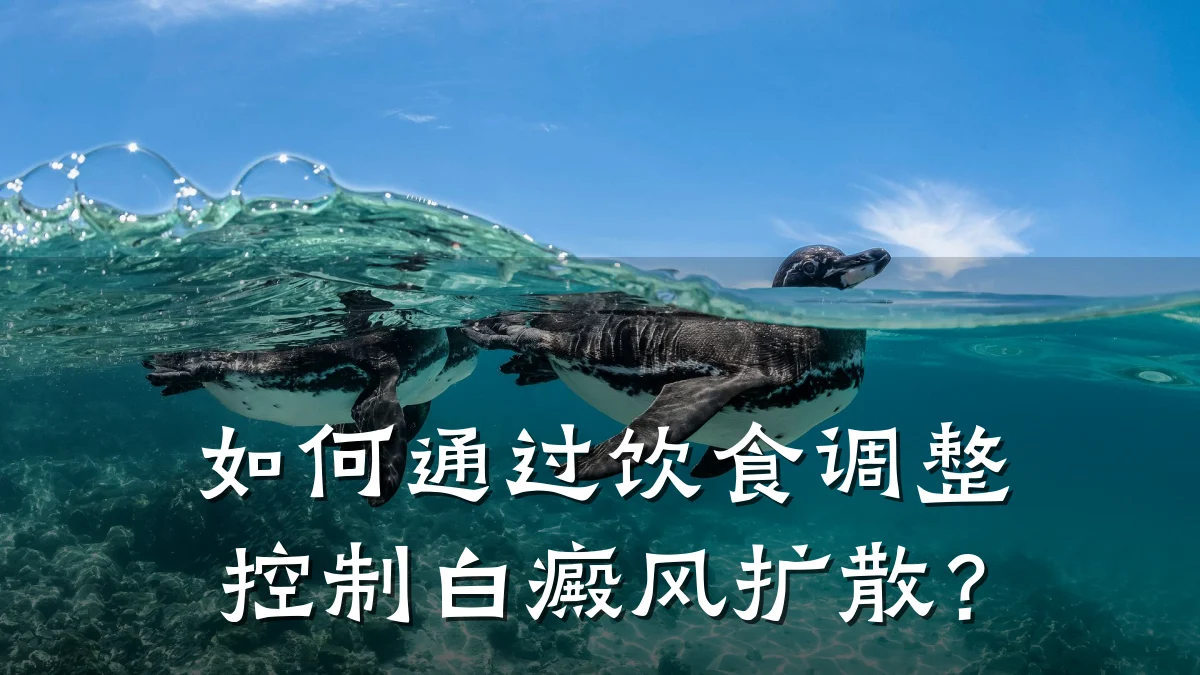 如何通过饮食调整控制白癜风扩散?
