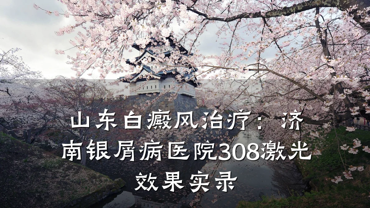 山东白癜风治疗：济南银屑病医院308激光效果实录