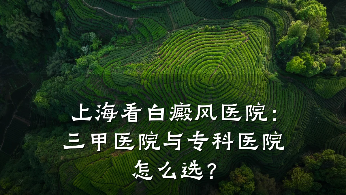 上海看白癜风医院:三甲医院与专科医院怎么选?