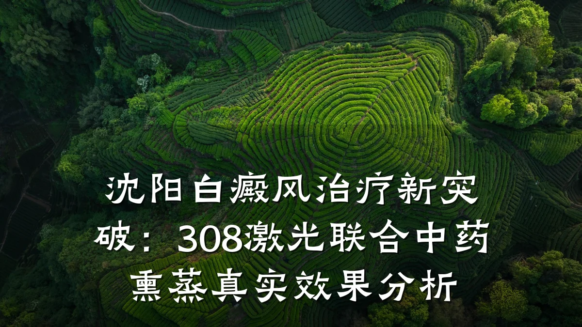 沈阳白癜风治疗新突破：308激光联合中药熏蒸真实效果分析