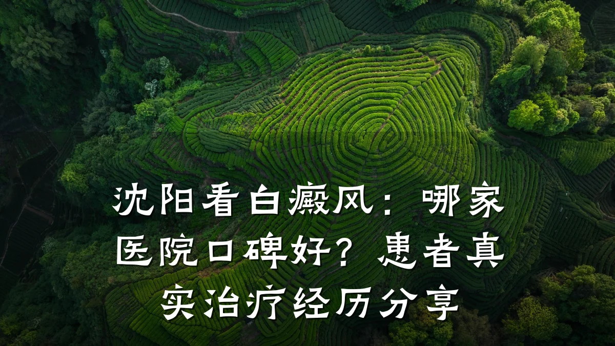 沈阳看白癜风:哪家医院口碑好?患者真实治疗经历分享