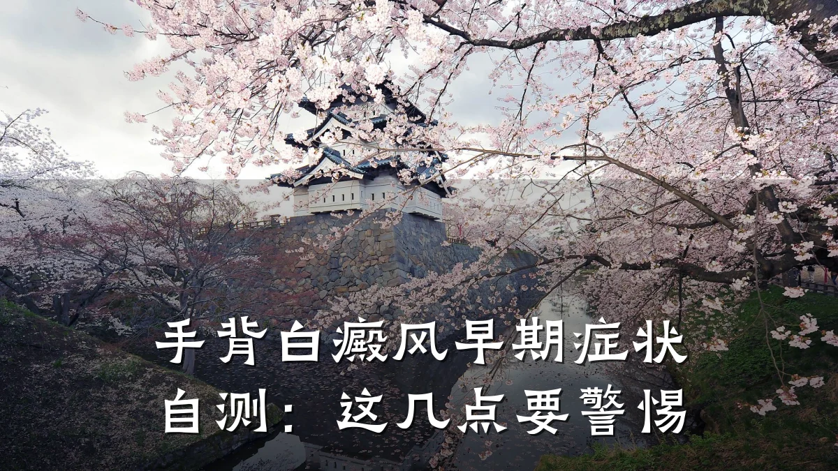 手背白癜风早期症状自测:这几点要警惕