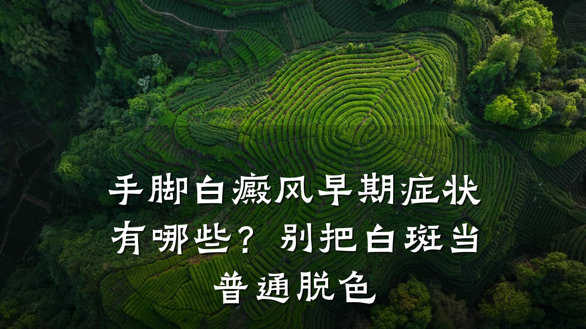 手脚白癜风早期症状有哪些?别把白斑当普通脱色