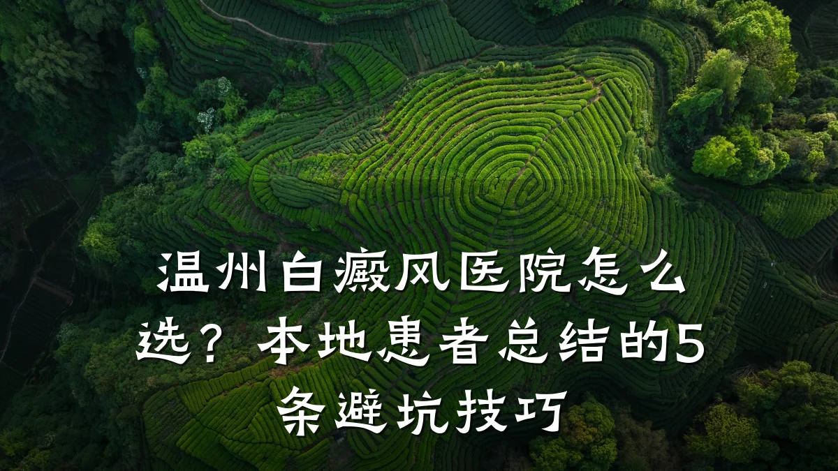 温州白癜风医院怎么选?本地患者总结的5条避坑技巧