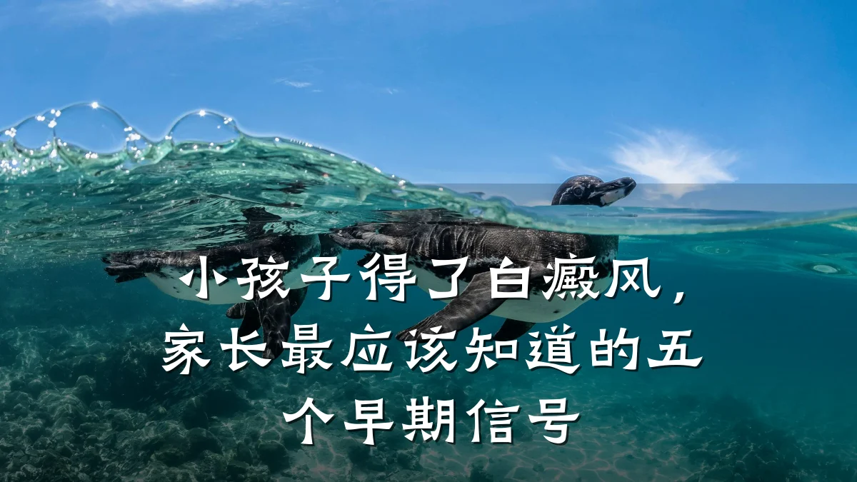 小孩子得了白癜风，家长最应该知道的五个早期信号