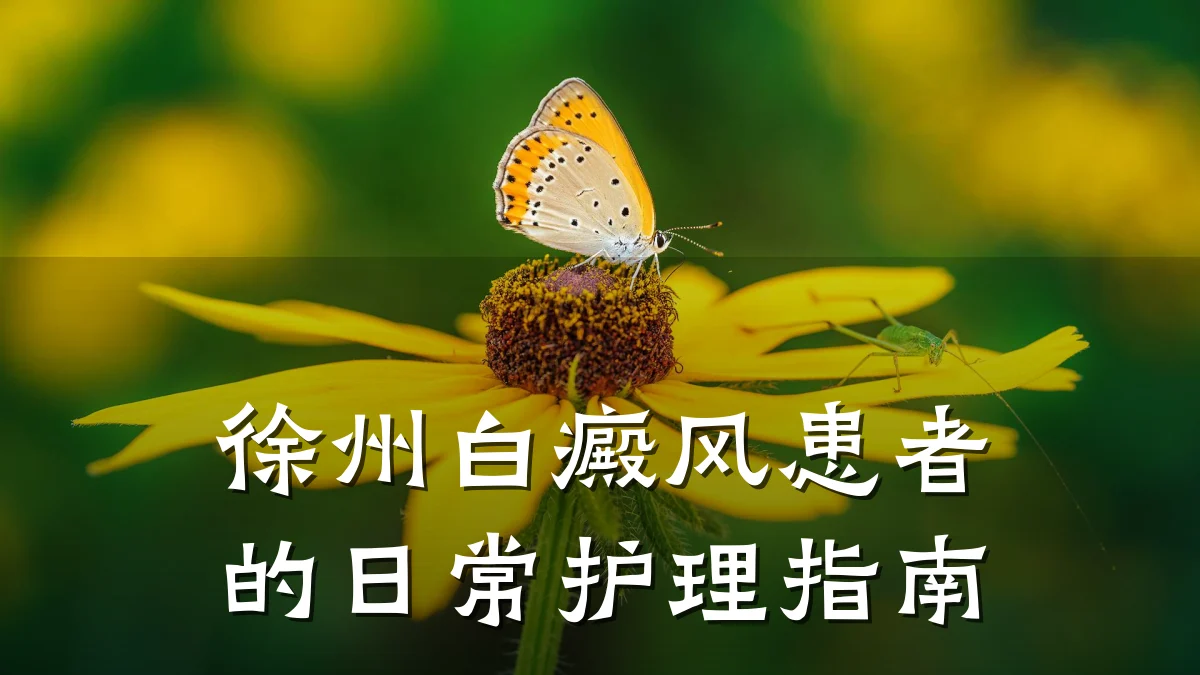 徐州白癜风患者的日常护理指南