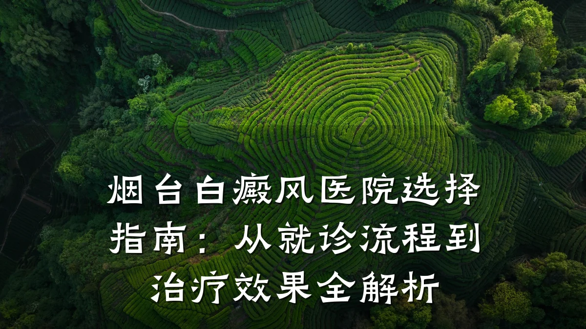 烟台白癜风医院选择指南：从就诊流程到治疗效果全解析