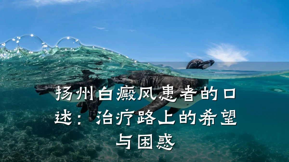 扬州白癜风患者的口述:治疗路上的希望与困惑