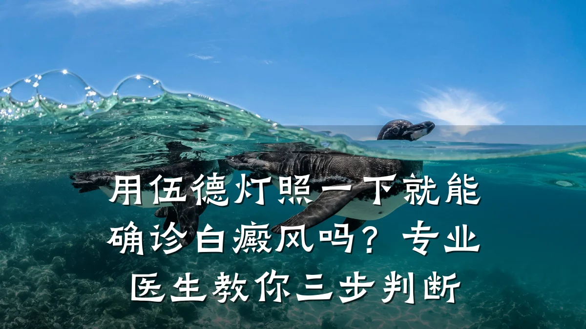 用伍德灯照一下就能确诊白癜风吗?专业医生教你三步判断