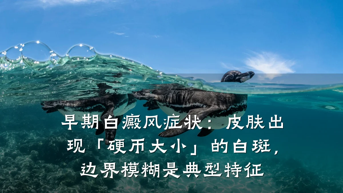 早期白癜风症状:皮肤出现「硬币大小」的白斑,边界模糊是典型特征