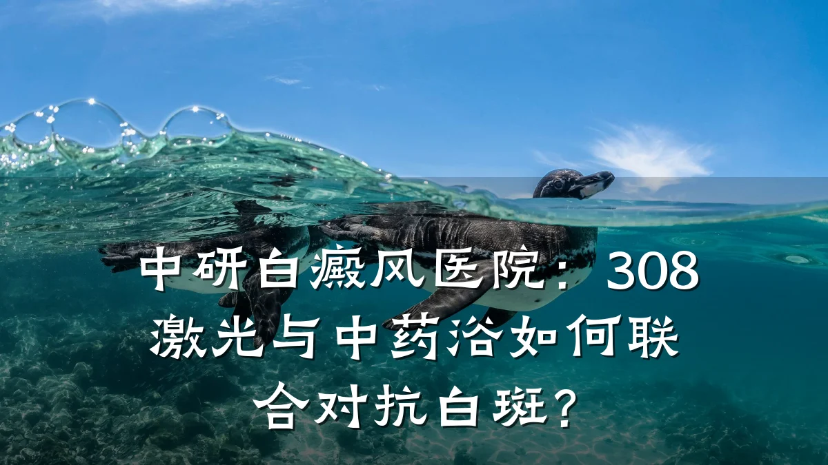 中研白癜风医院:308激光与中药浴如何联合对抗白斑?