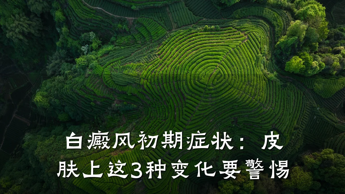 白癜风初期症状:皮肤上这3种变化要警惕