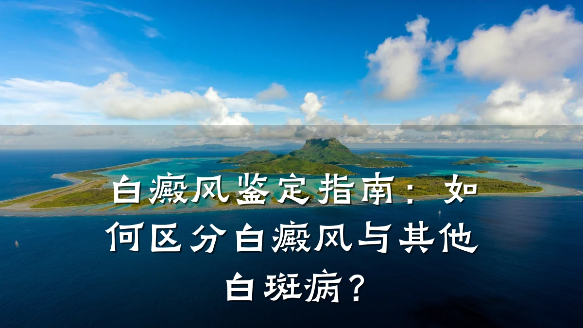 白癜风鉴定指南:如何区分白癜风与其他白斑病?