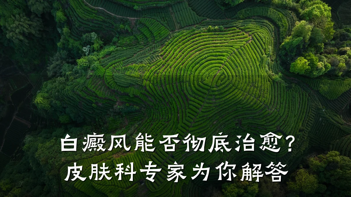 白癜风能否彻底治愈?皮肤科专家为你解答