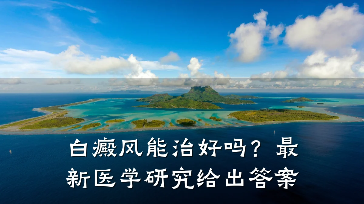 白癜风能治好吗?最新医学研究给出答案