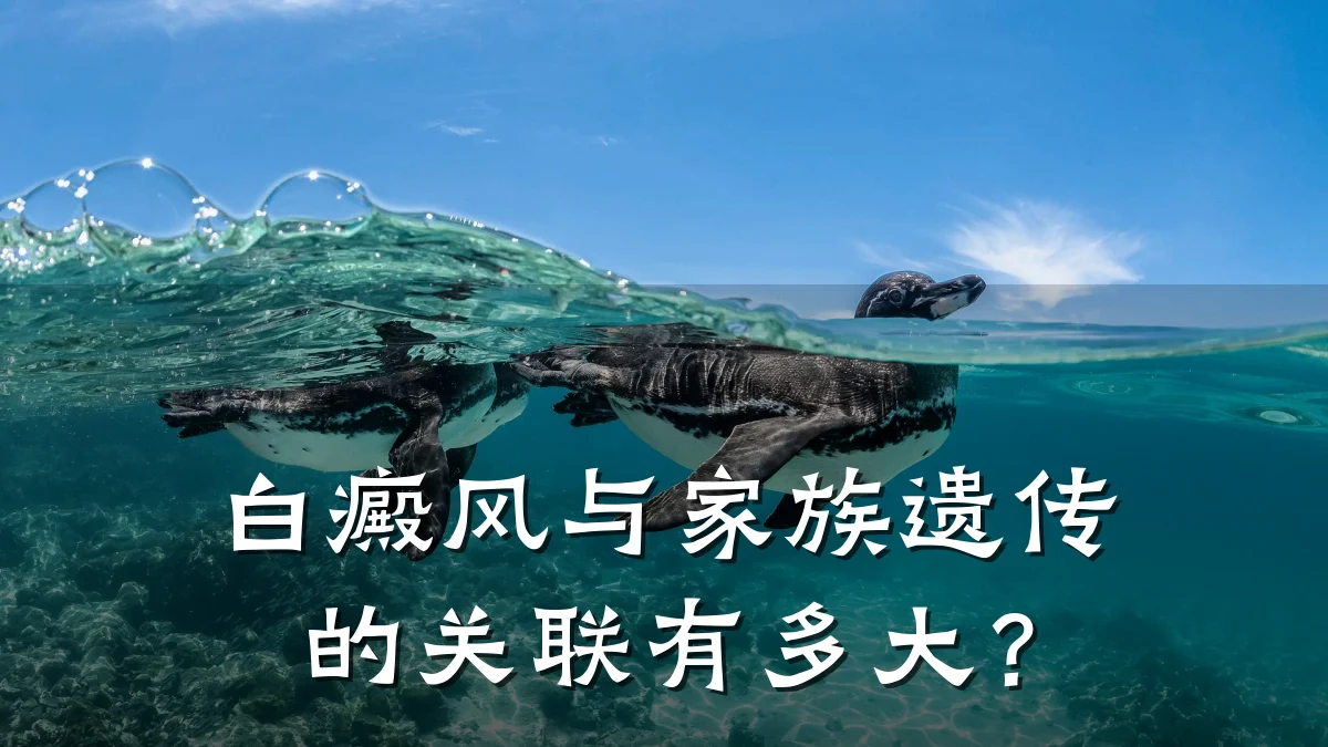 白癜风与家族遗传的关联有多大?