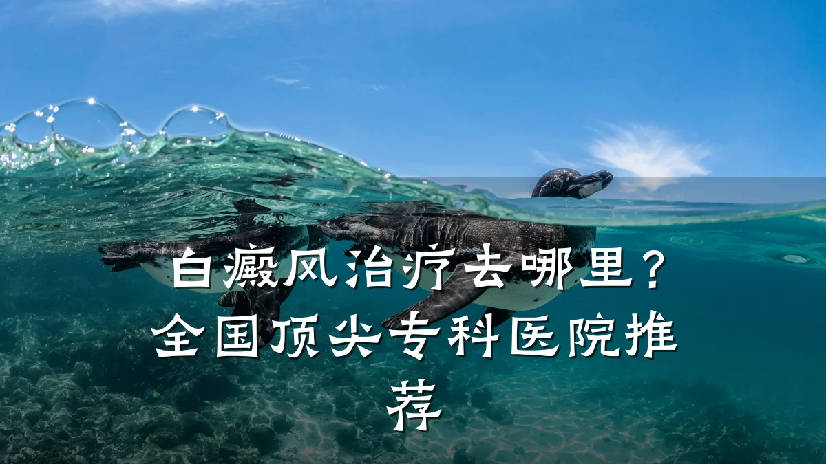 白癜风治疗去哪里?全国顶尖专科医院推荐