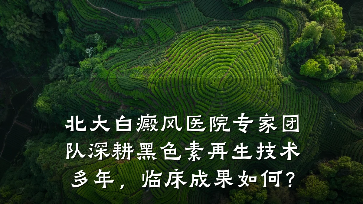 北大白癜风医院专家团队深耕黑色素再生技术多年,临床成果如何?