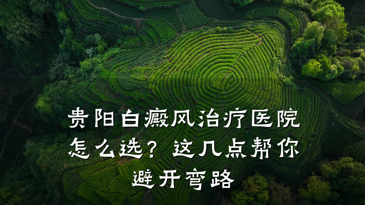 贵阳白癜风治疗医院怎么选?这几点帮你避开弯路