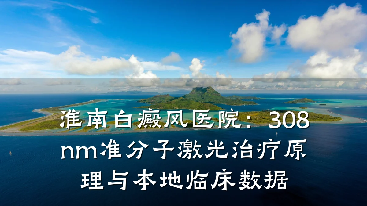 淮南白癜风医院：308nm准分子激光治疗原理与本地临床数据