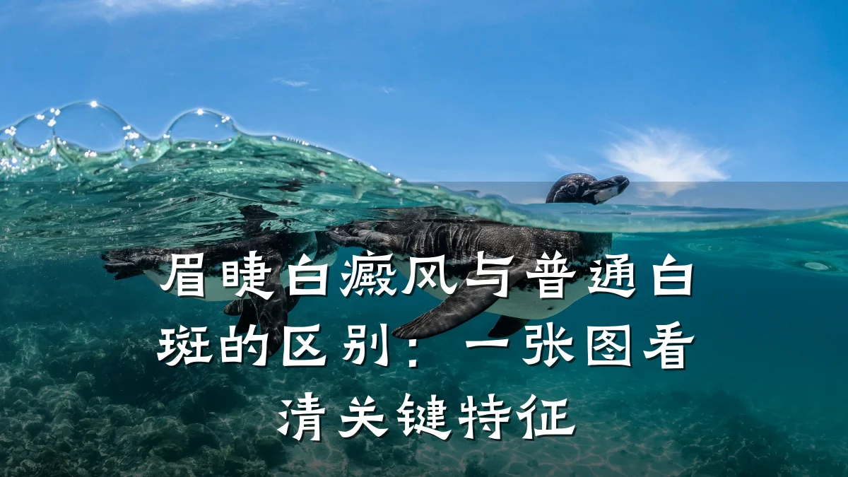 眉睫白癜风与普通白斑的区别：一张图看清关键特征