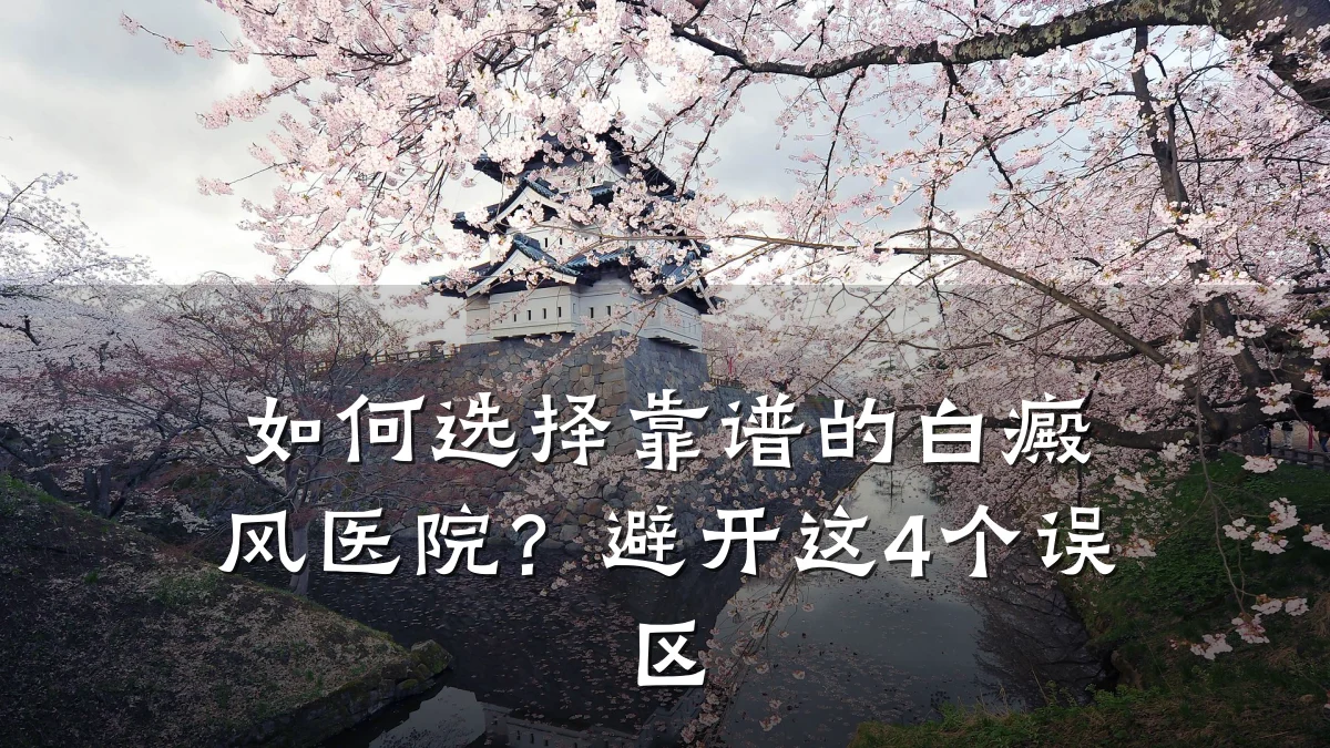 如何选择靠谱的白癜风医院?避开这4个误区