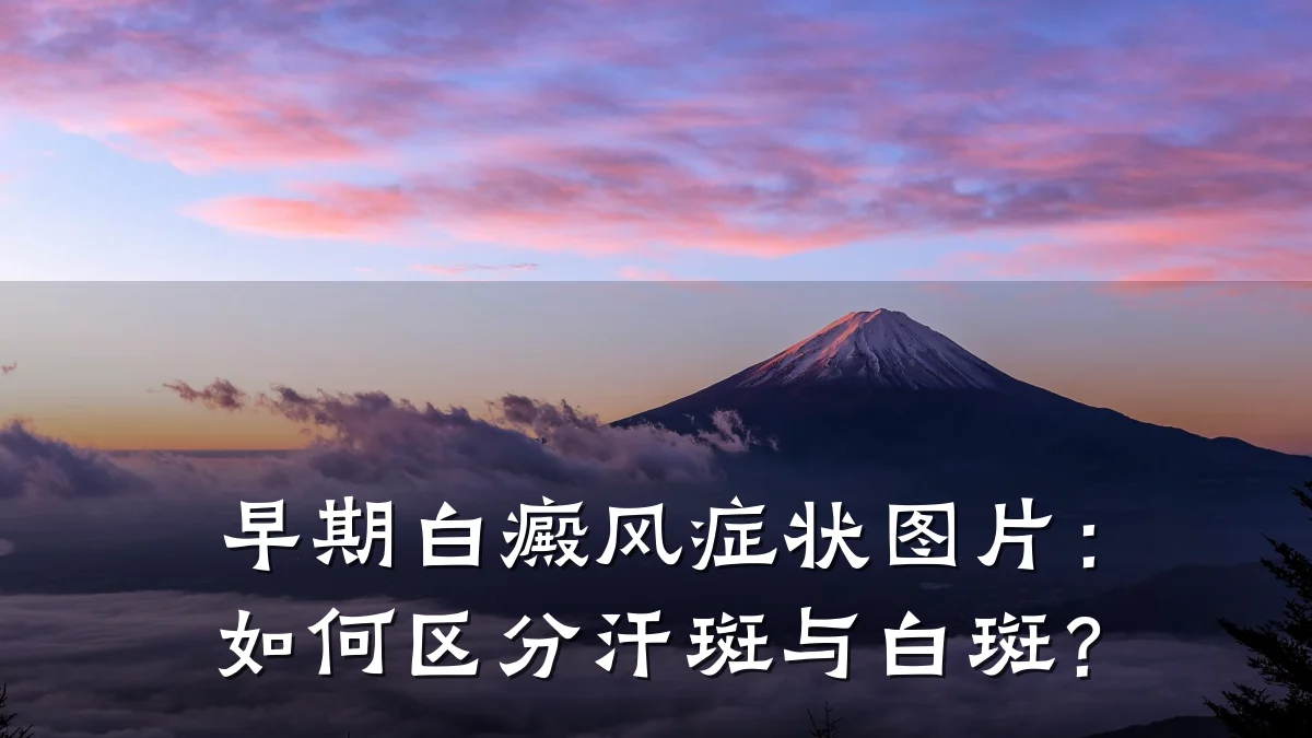 早期白癜风症状图片:如何区分汗斑与白斑?