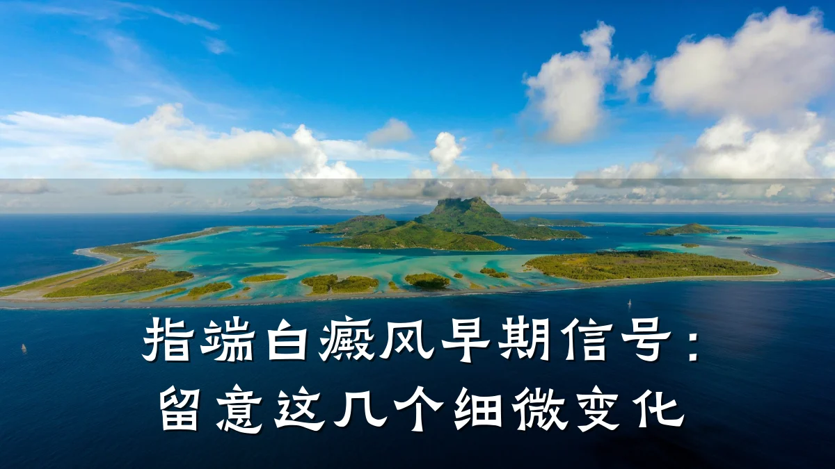 指端白癜风早期信号:留意这几个细微变化