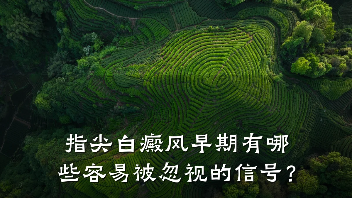 指尖白癜风早期有哪些容易被忽视的信号?