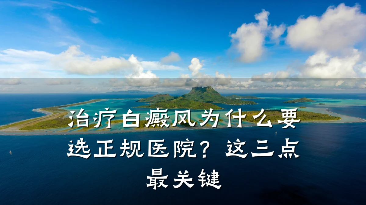 治疗白癜风为什么要选正规医院?这三点最关键