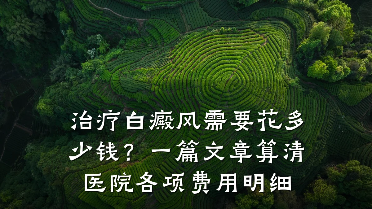 治疗白癜风需要花多少钱?一篇文章算清医院各项费用明细