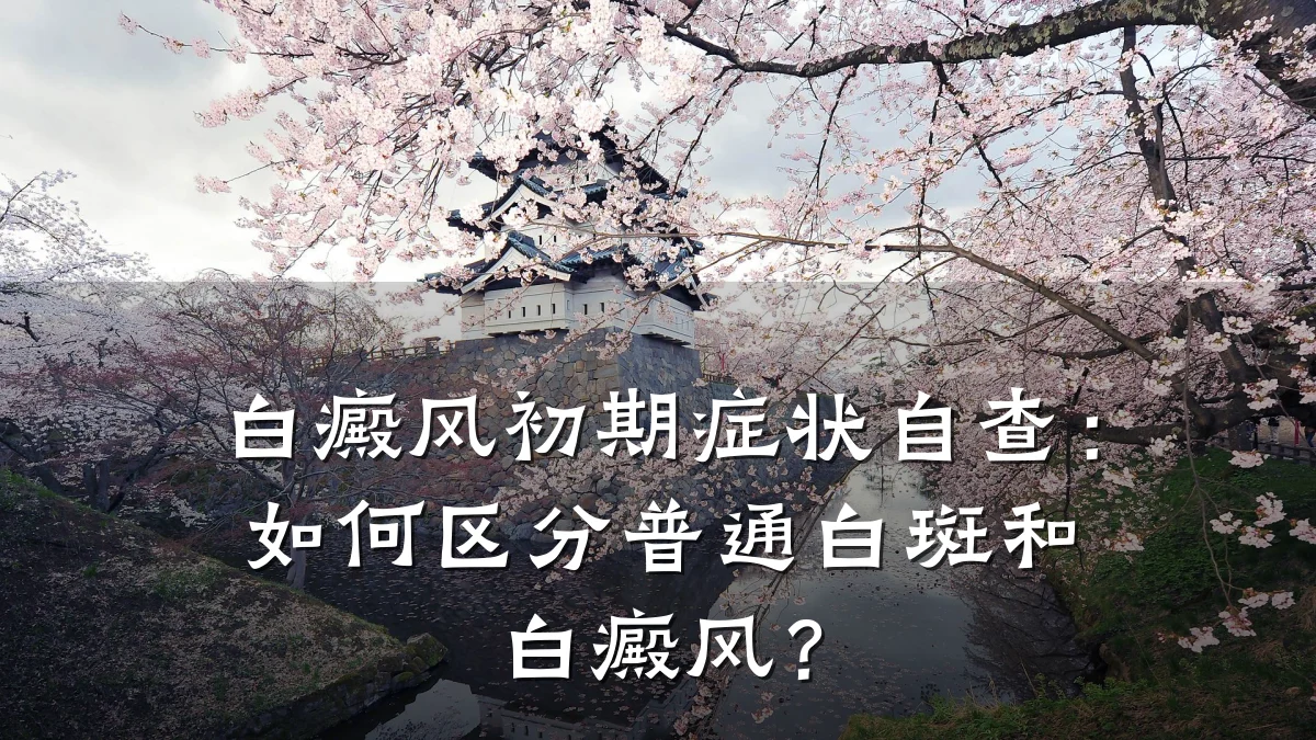 白癜风初期症状自查：如何区分普通白斑和白癜风？