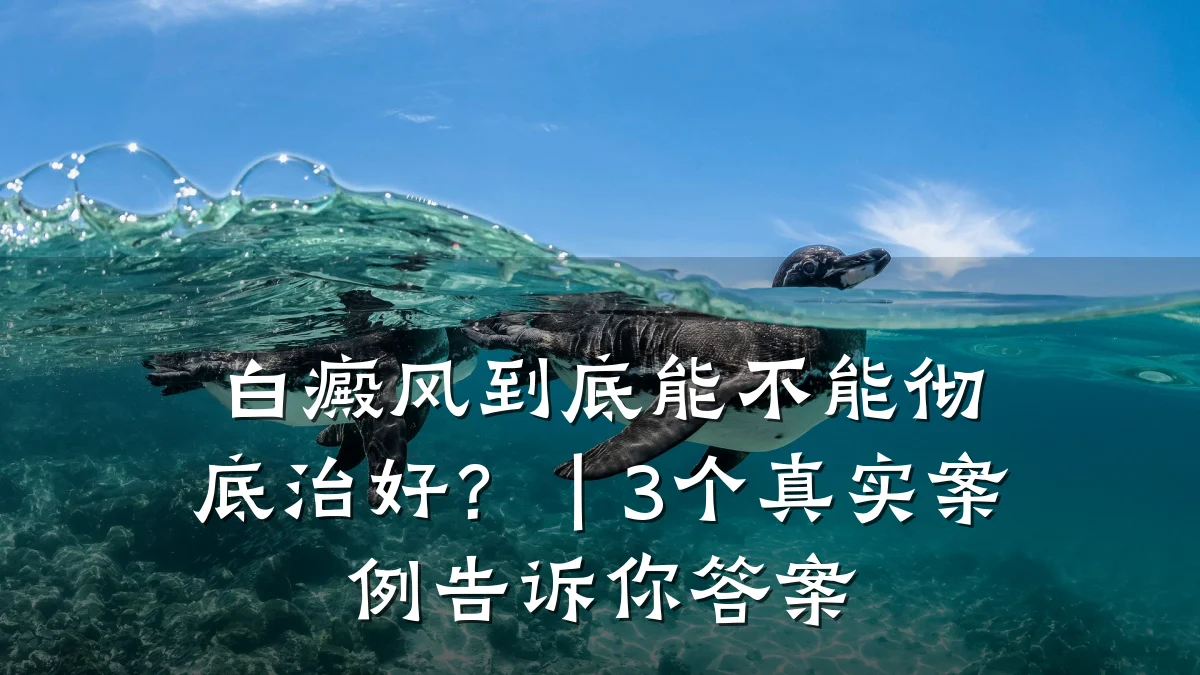 白癜风到底能不能彻底治好?|3个真实案例告诉你答案