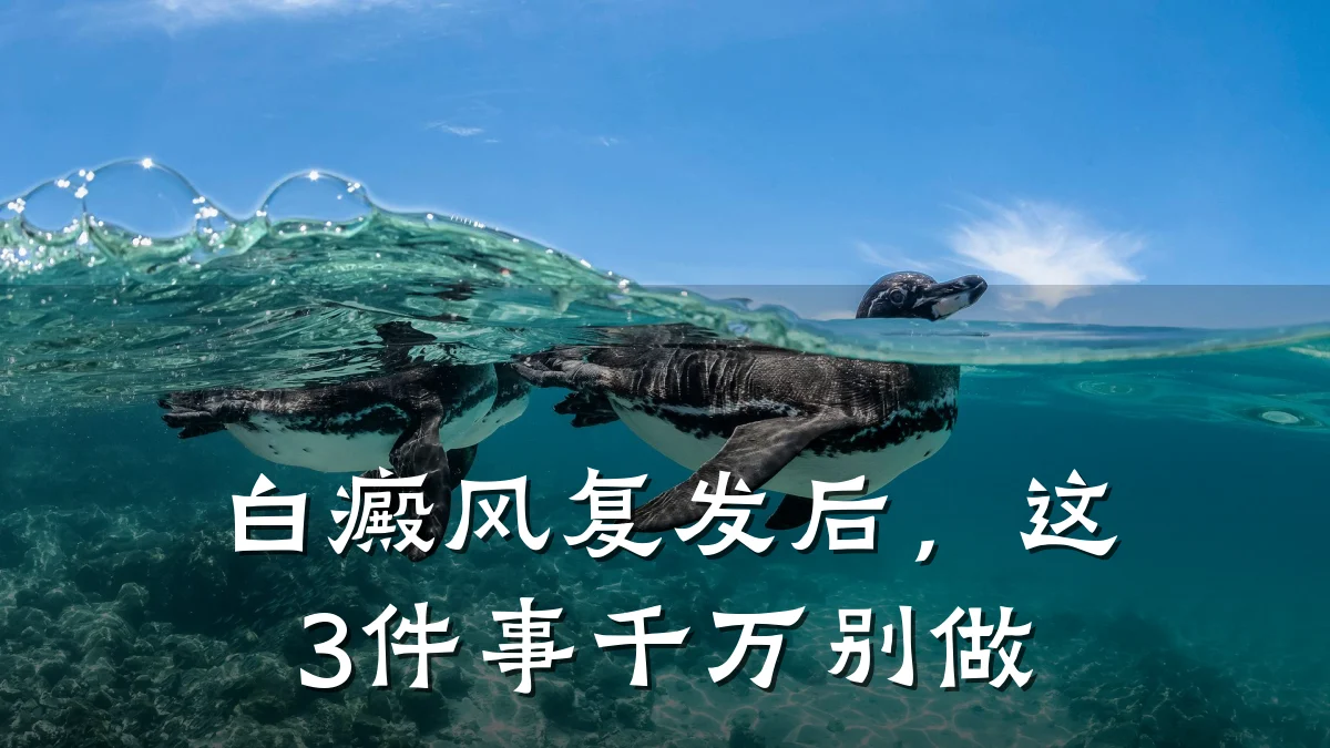 白癜风复发后,这3件事千万别做
