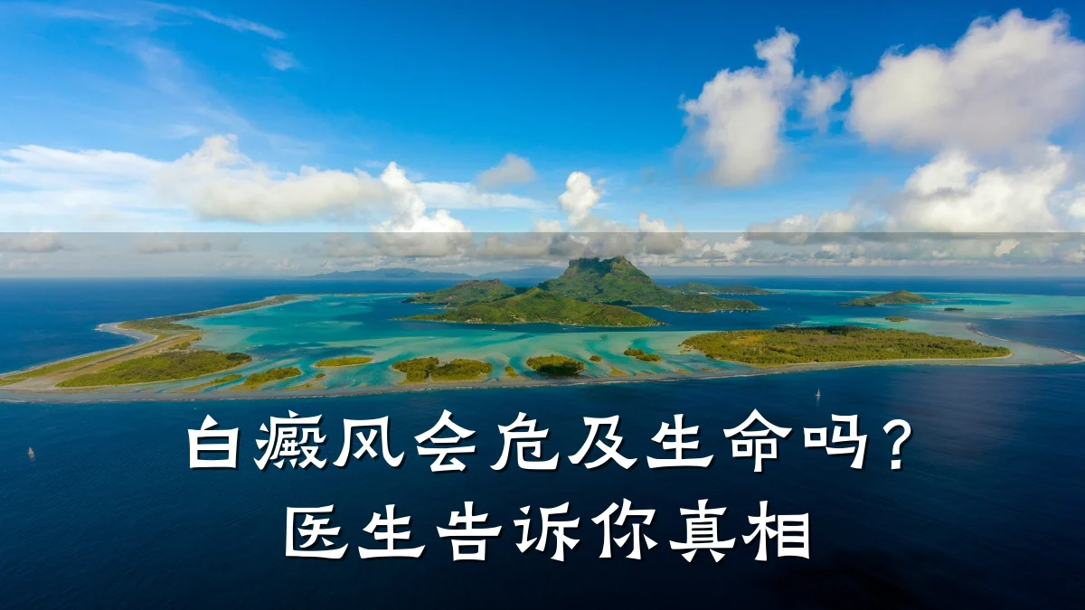 白癜风会危及生命吗?医生告诉你真相