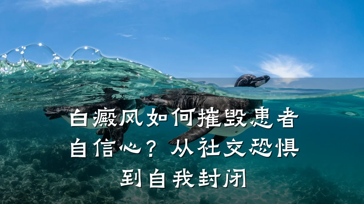 白癜风如何摧毁患者自信心?从社交恐惧到自我封闭