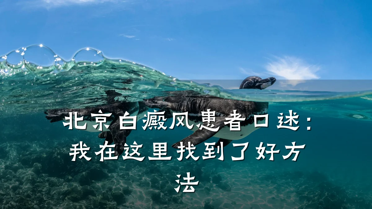 北京白癜风患者口述:我在这里找到了好方法
