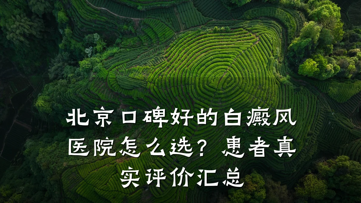 北京口碑好的白癜风医院怎么选?患者真实评价汇总