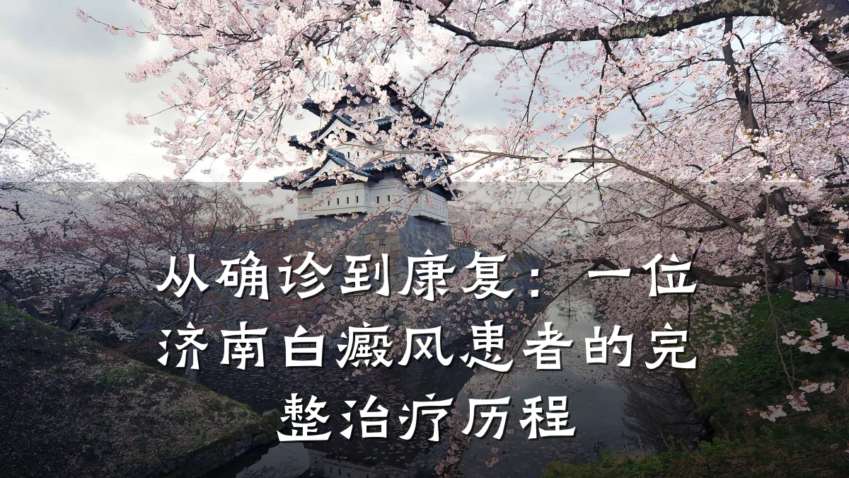 从确诊到康复:一位济南白癜风患者的完整治疗历程