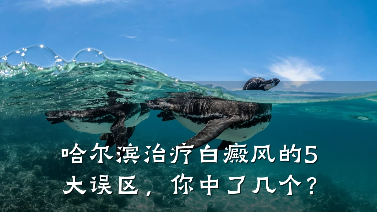 哈尔滨治疗白癜风的5大误区,你中了几个?