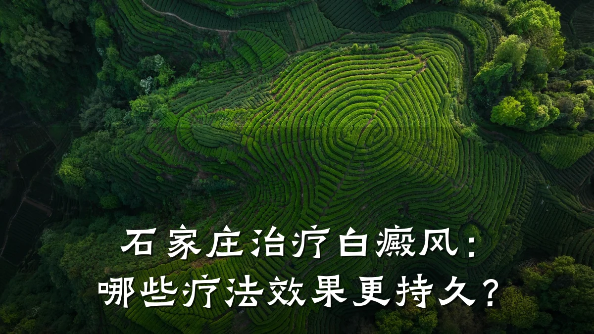 石家庄治疗白癜风:哪些疗法效果更持久?